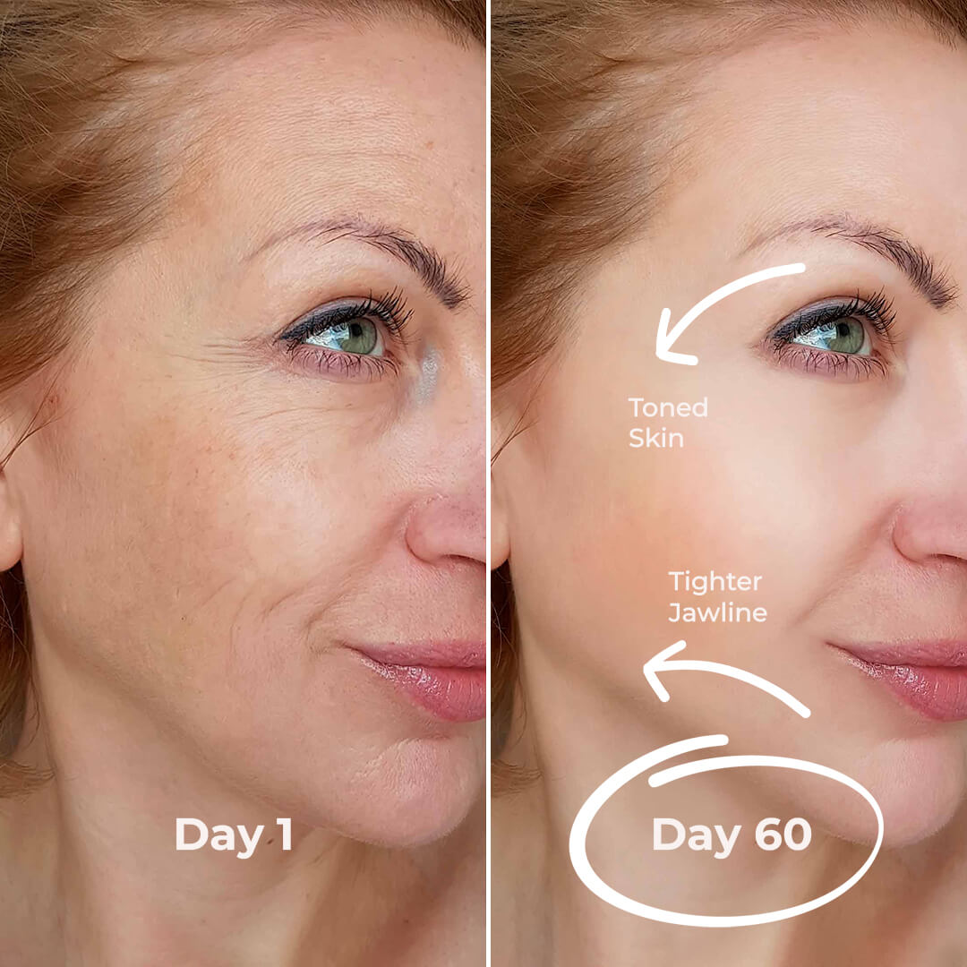 5MinSkin MicroSculpt + Hyaluronic Acid Serum (30 Day Supply)