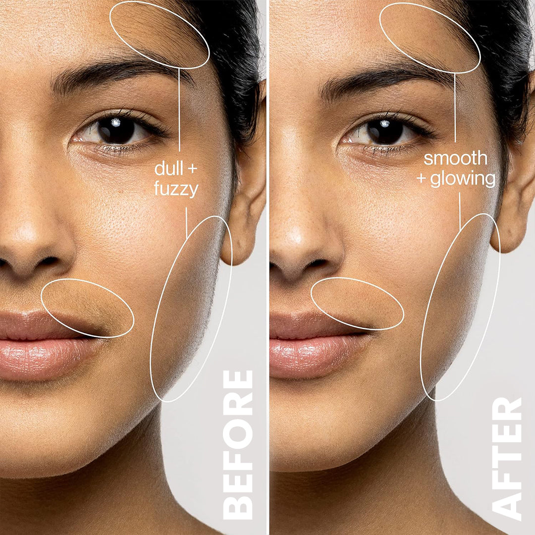 5MINSKIN ELECTRIC DERMAPLANING TOOL + FREE HAIR IDENTIFIER SPRAY - 50% OFF  BLACK FRIDAY SALE