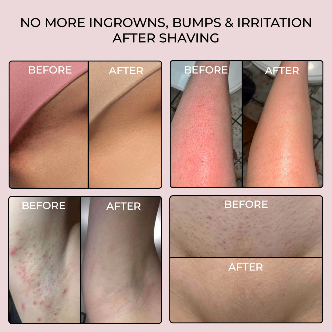 5MINSKIN ELECTRIC SHAVER FOR WOMEN - 50% OFF MOTHER'S DAY SALE